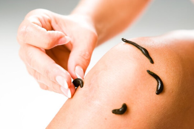 Leech Therapy
